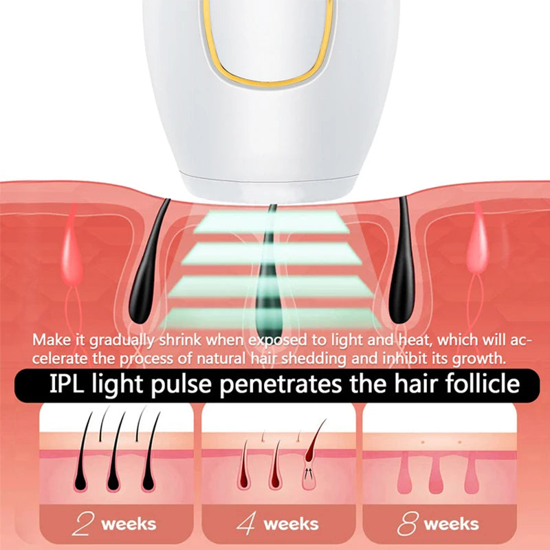 Depilador a Laser IPL Profissional - Remoção de Pelos Permanente para Mulheres e Homens, Aparelho para Uso em Casa